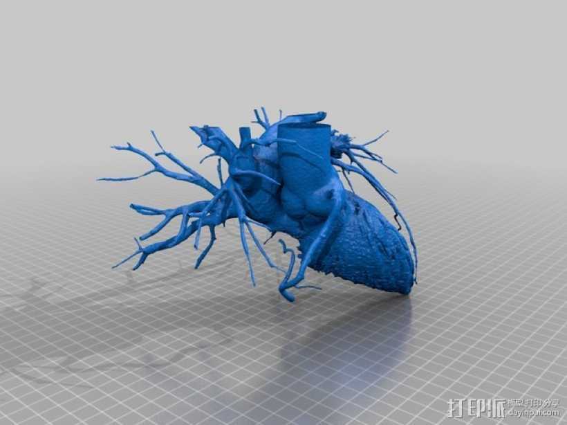 心脏和血管  模型 3D打印模型渲染图