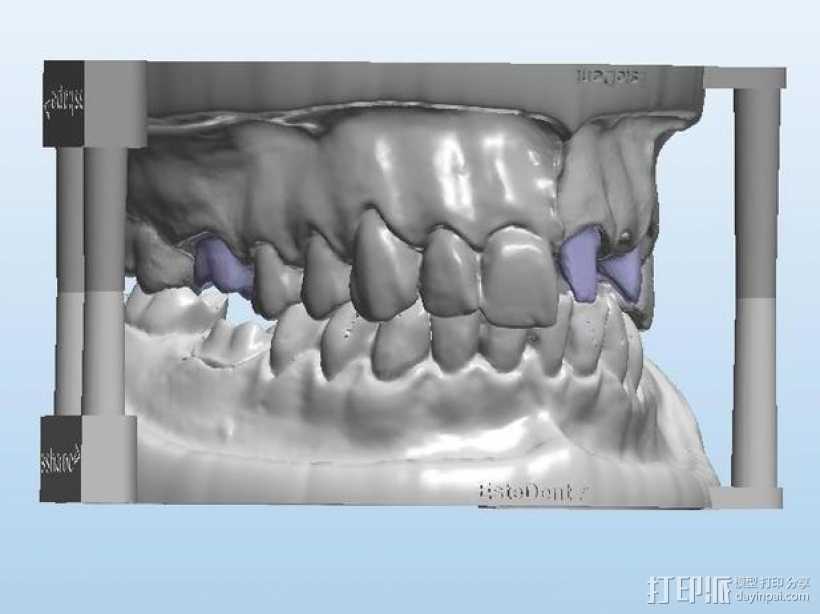 牙齿模型 3D打印模型渲染图
