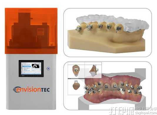 新款牙科用3D打印材料--E－IDB