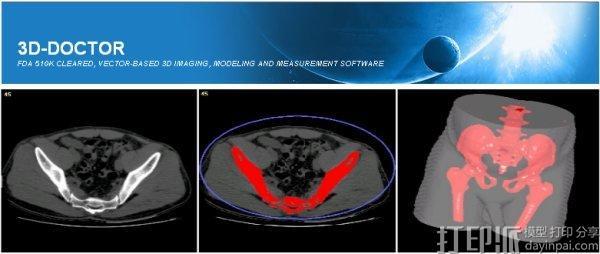 醫(yī)用3D圖形建模軟件--Able Software 3D-Doctor