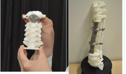 北大第三医院刘忠军：3D打印钛合金骨骼挺起中国人的脊梁