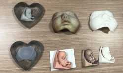 暖心服务！香港一医院为预产期父母提供3D打印胎儿模型