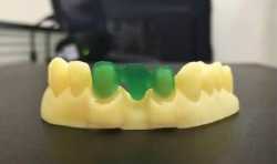 WELLS成功开发出专属齿科3D打印机  打造新一代数字化齿科打印专家