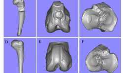 3D扫描技术登上综合性学术期刊，或将改变未来骨科手术