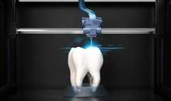 极光尔沃推出齿科专用3D打印机 3D打印种植牙缩短治疗周期