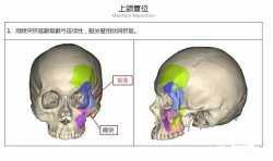 富源25岁小伙面部受重伤  3D打印技术助其“再造”新脸