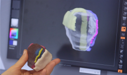 纽约工作室与医院合作将全彩3D打印前列腺肿瘤模型用于临床试验