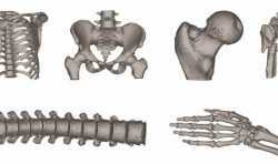 聚焦3D打印人工骨，西安博恩生物欲切入医疗细分市场 