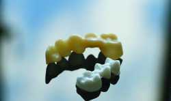 上海应用技术大学创新陶瓷材料3D打印 最大应用于牙齿打印