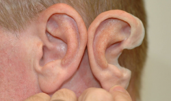3D打印可复制你的耳朵？慈溪这个产业园将颠覆你