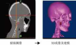 港股市场将迎来中国首家3D打印技术商业化公司--爱康医疗