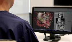 3D Systems推出D2P虚拟现实技术 助力精准医疗