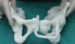“甘肃省骨科3D打印工程研究中心”获准立项建设