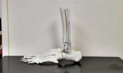 南京大学医学3D打印研究所致力生物3D打印修复患者骨损伤