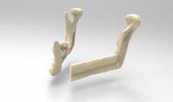 雷尼绍与威尔士大学医院合作，为癌症患者提供3D打印指南和下颌骨种植体