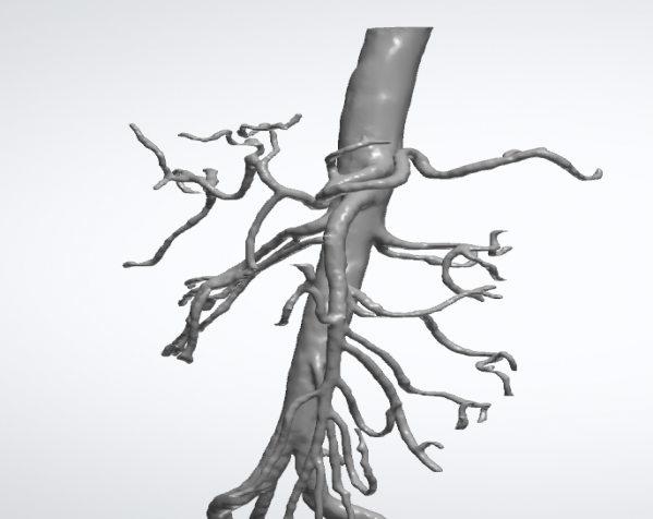 人体动脉血管 3D打印模型渲染图