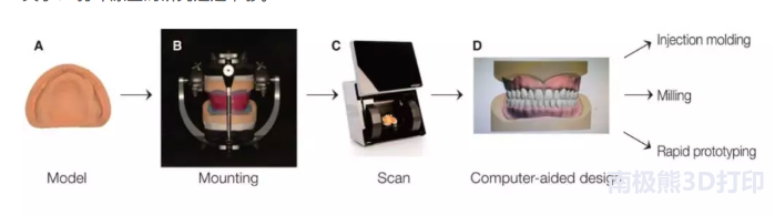 与磨制和注射成型假牙相比，3D打印假牙如何叠加？
