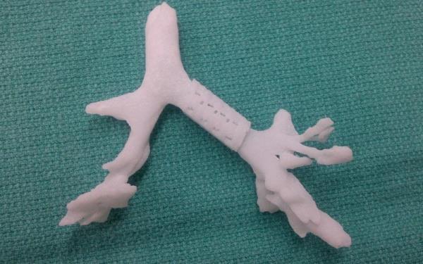 materialise-calls-evidence-based-approach-medical-3d-printing4.JPG