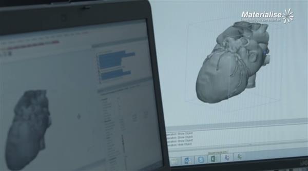 materialise-calls-evidence-based-approach-medical-3d-printing3.jpg