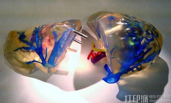 3D打印技术在医学中的应用 救死扶伤有功劳.jpg