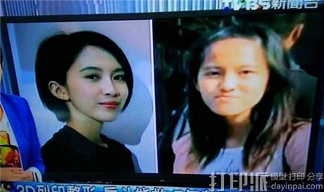 台湾女生7年花70万做3D打印整形手术 变身正妹.jpg