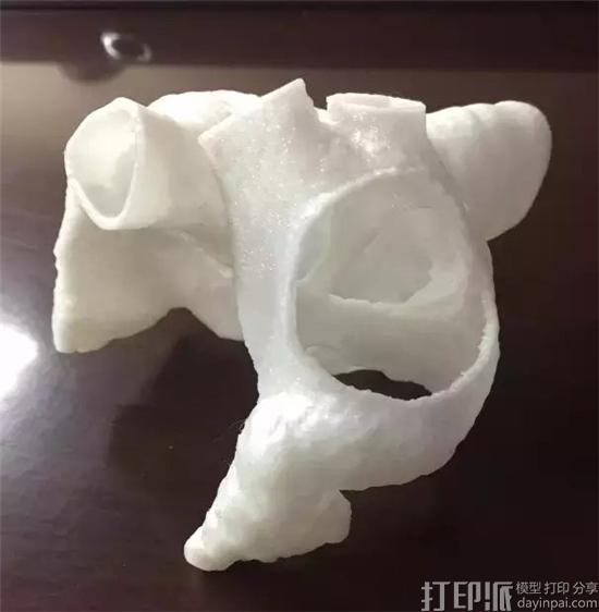 3D打印打破手术禁区 我国完成首例下腔型房缺手术.jpg