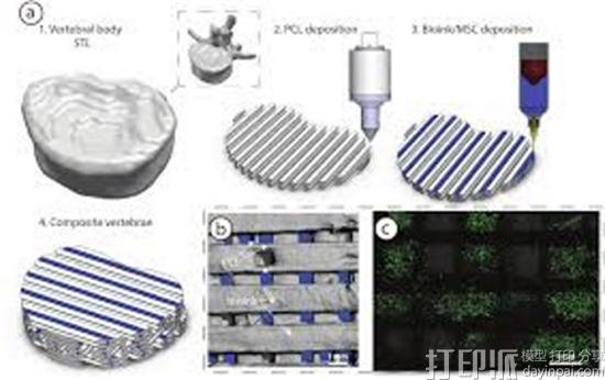 3D-printed-bone-implant-regrow-bone-3.jpg
