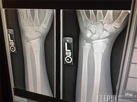could-gold-and-3d-scanning-spell-the-end-of-old-school-x-rays-3.jpg