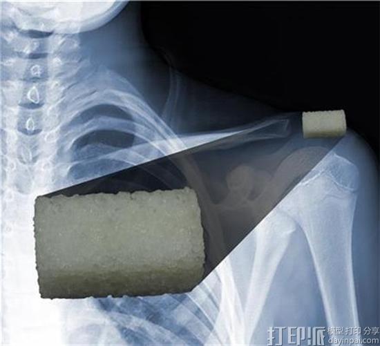 puebla-researchers-unveil-new-3d-printable-implant-material-that-facilitates-bone-regeneration-2.jpg