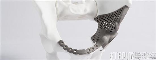 1473836528612460.jpg amt-teams-eos-showcase-additive-bionic-human-imts-2016-2.jpg