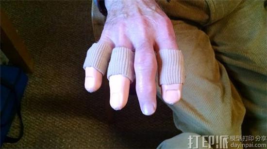 create-orthotics-and-prosthetics-launches-all-in-one-medical-grade-3d-printer-for-prosthetics-3.jpg