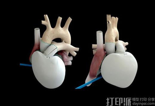 法国Carmat公司第二个3D打印人造心脏产品预计在2017年诞生.jpg