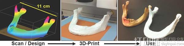 synthetic-3d-printed-hyperelastic-bone-induces-bone-regeneration-could-mend-broken-bones-6.jpg