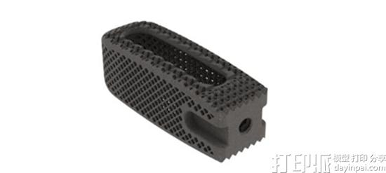 医疗设备公司K2M孔隙率达70%的3D打印钛植入物获FDA许可.jpg