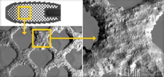 fda-approves-70-percent-porous-3d-printed-titanium-spinal-implants-k2m-3.jpg