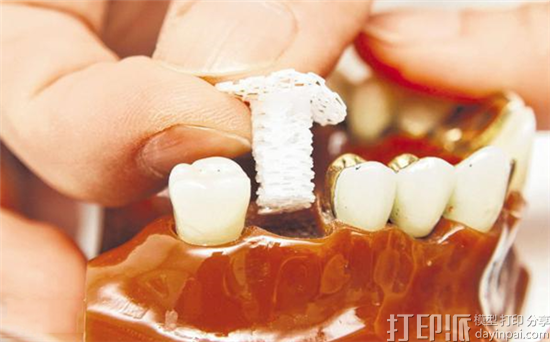 新加坡科学家3D打印生物支架 可植入人体促进骨骼生长.png 新加坡科学家3D打印生物支架 可植入人体促进骨骼生长.png