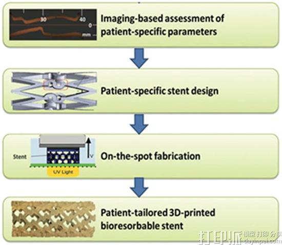 1476339833684504.jpg northwestern-researchers-pioneer-custom-3d-printed-biodegradable-vascular-stents-2.jpg