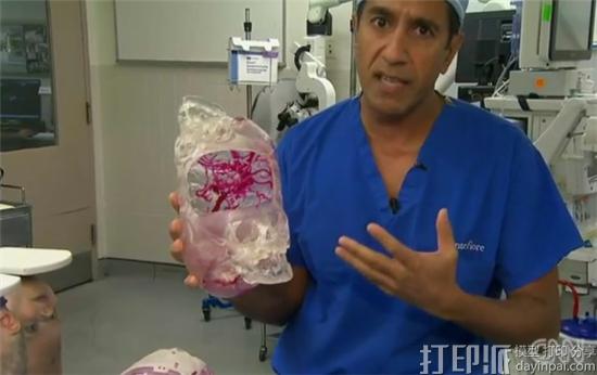 3d-printing-and-scanning-give-twins-conjoined-at-the-head-a-fighting-chance-6.jpg