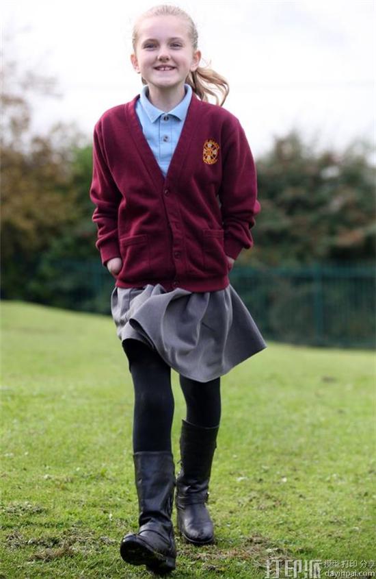 11-year-old-tilly-tests-3d-printed-deus-ex-prosthetic-arm-by-open-bionics-after-losing-hands-to-meningitis-2.jpg