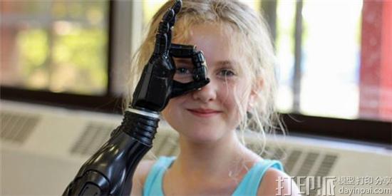 11-year-old-tilly-tests-3d-printed-deus-ex-prosthetic-arm-by-open-bionics-after-losing-hands-to-meningitis-4.jpg