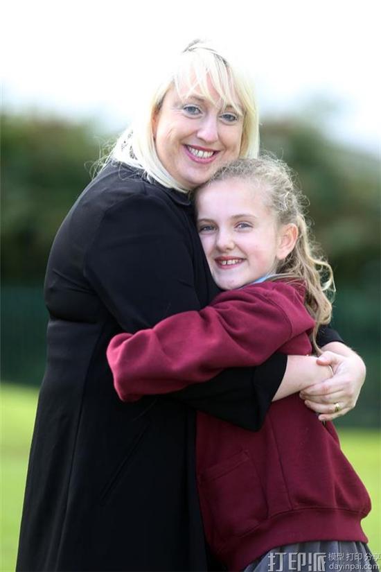 11-year-old-tilly-tests-3d-printed-deus-ex-prosthetic-arm-by-open-bionics-after-losing-hands-to-meningitis-1.jpg