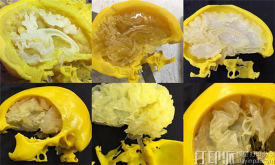 Stratasys为美国医院制造逼真的人脑解剖3D打印模型.jpg