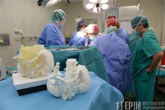 为什么越来越多的医院都开始用3D打印模型做手术预演？有什么好处？.jpg
