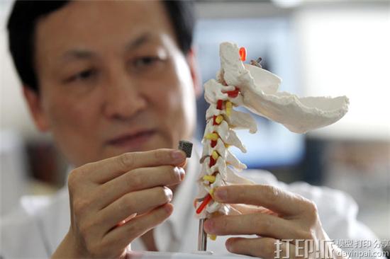3D打印的可植入骨骼对于医疗来说意味着什么？有哪些好处？.jpg