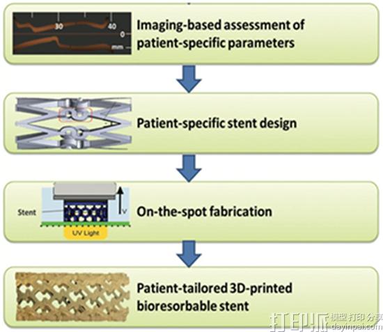 3d-printing-customized-vascular-stents-b.jpg