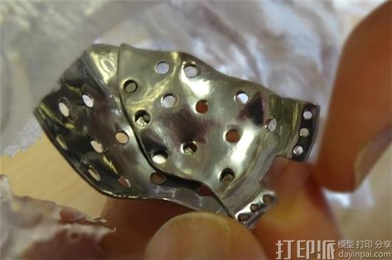 英国专家开发出能简化定制3D打印面部植入物过程的系统.jpg