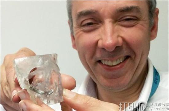 innovative-adept-system-simplify-3d-printing-bespoke-maxillofacial-implants-2.jpg