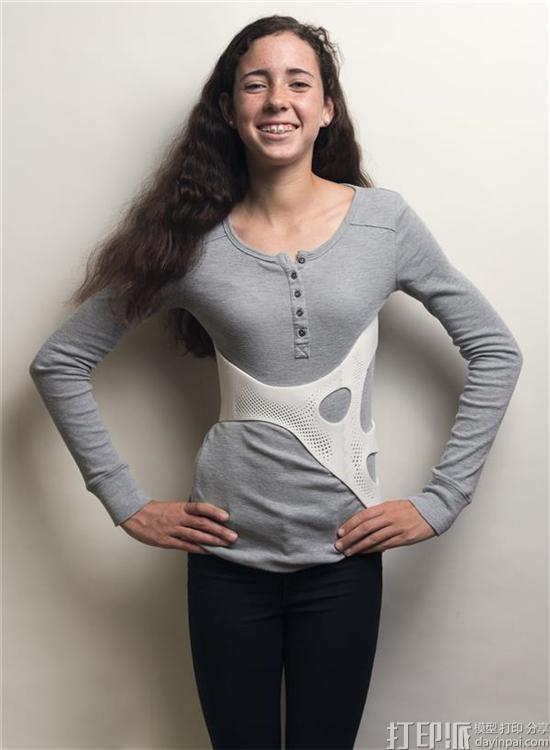 stylish-3d-printed-back-brace-brings-fashionable-look-to-female-scoliosis-patients-3.jpg