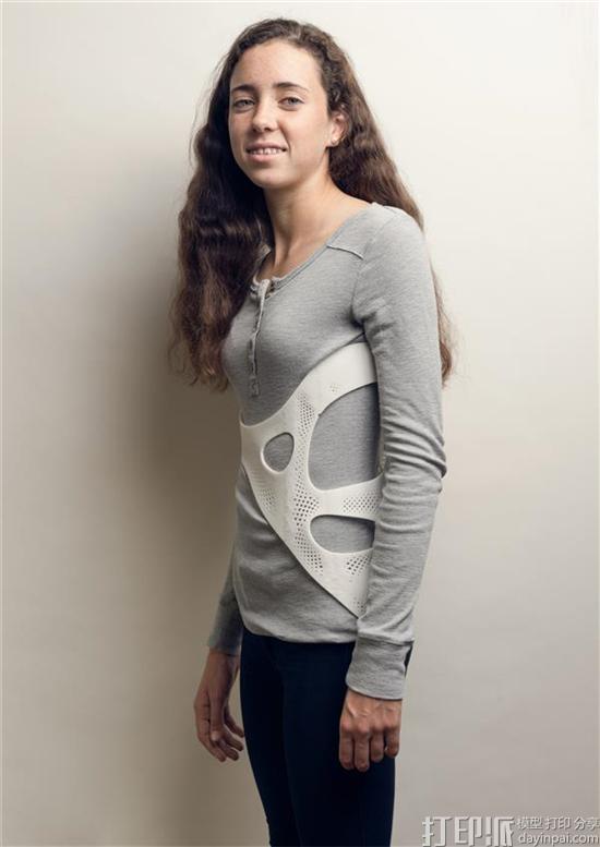 stylish-3d-printed-back-brace-brings-fashionable-look-to-female-scoliosis-patients-5.jpg