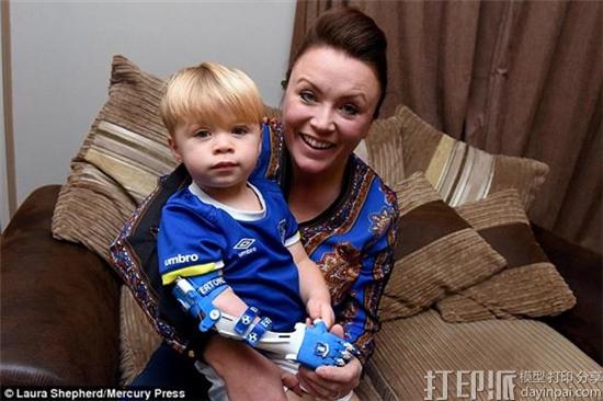 two-year-old-everton-fan-kobi-receives-3d-printed-arm-emblazoned-with-team-logo-6.jpg